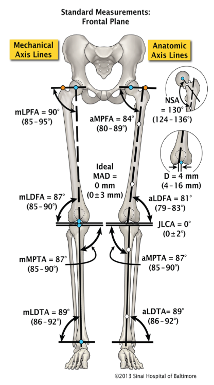 Test de Alineación y Orientación de los Miembros Inferiores en el Plano Coronal